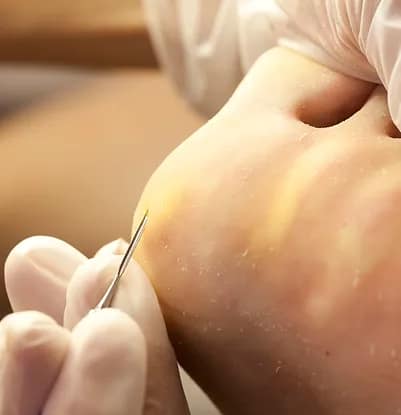 JPポドロジー科 専科 マシンケアコース - 爪ケアも学べる全国展開の