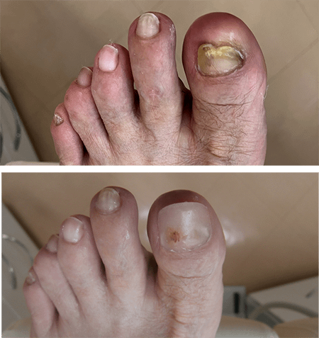 ネイルエキスパート科 本科 - 爪ケアも学べる全国展開のフットケアスクール